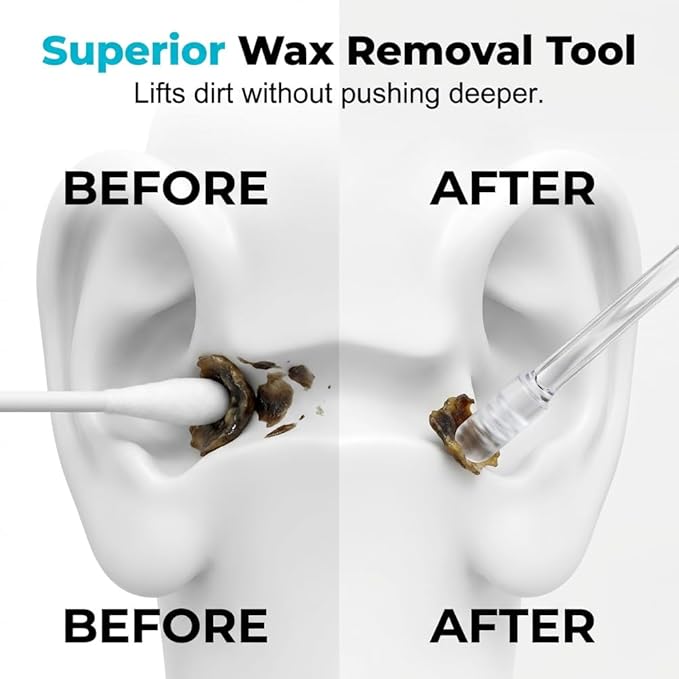 Sticky Ear Cleaning Stick, 2026 New Sticky Ear Cleaner Picks, Ear Wax Removal Tools, Ear Pick Cleaning Stick for Adults, Reusable Earwax Adhesive Cleaning Tools for Daily Ear Care (24pcs, Large)