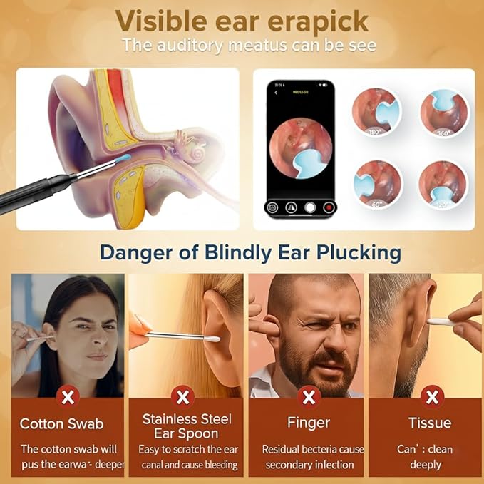 Ear Wax Removal Tool with Camera - 1296P HD Ear Cleaner Otoscope with 6 LED Lights, Wireless Earwax Remover Kit with 8 Pcs Ear Picks, WiFi Ear Scope Cleaning Kit for iPhone (Onyx)
