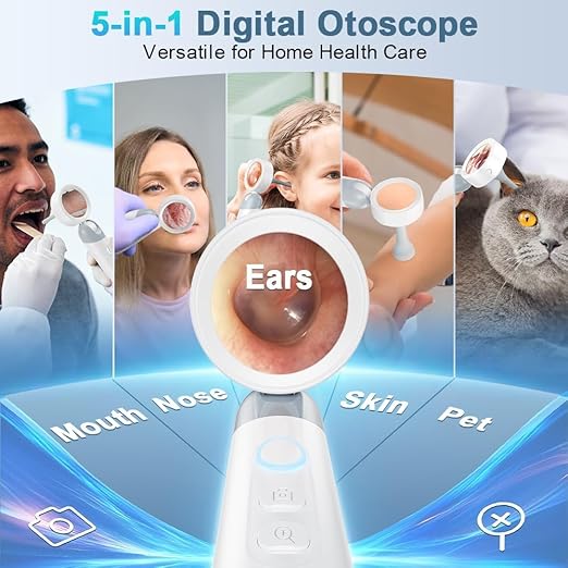 Otoscope Ear Camera with Light, 1.4” Screen 1080P HD Ear Scope, 12 Silicone Specula Tips, Photo & Video Recording, Type-C Rechargeable, Ear Otoscope Camera for Adult Kid and Pet