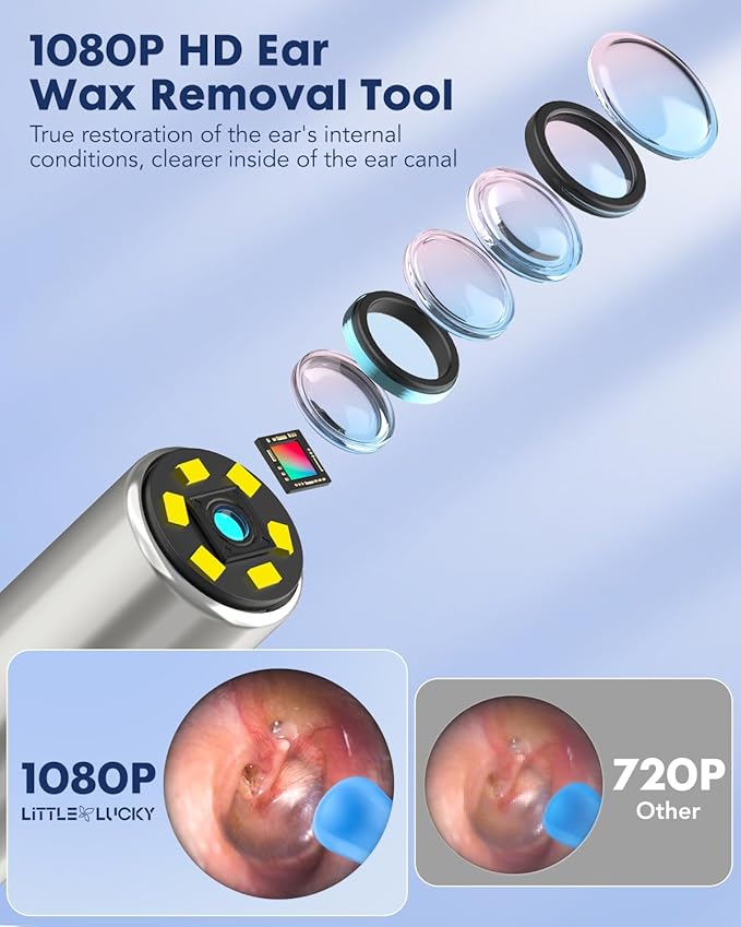 Ear Wax Removal,Littlelucky- 4 in 1 Ear Canal Cleaner 1080P HD Lens with 6 LED Lights for Ear/Nose/Throat/Skin Viewing,Ear Cleaning Kit with 6 Piece Ear Set & 9 Replacement Tips for iOS & Android