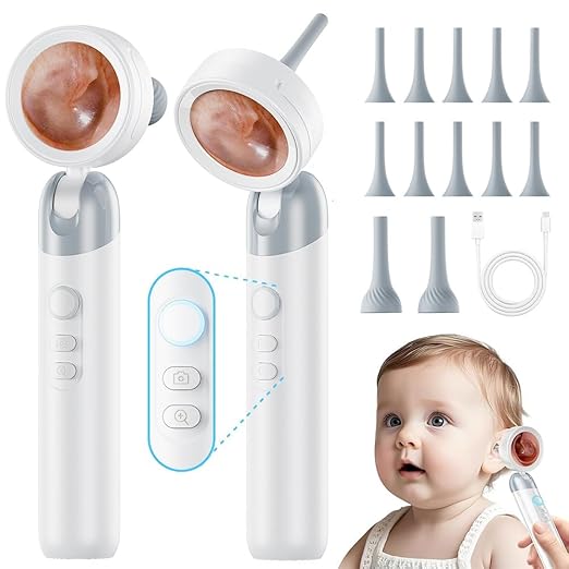 Otoscope Ear Camera with Light, 1.4” Screen 1080P HD Ear Scope, 12 Silicone Specula Tips, Photo & Video Recording, Type-C Rechargeable, Ear Otoscope Camera for Adult Kid and Pet