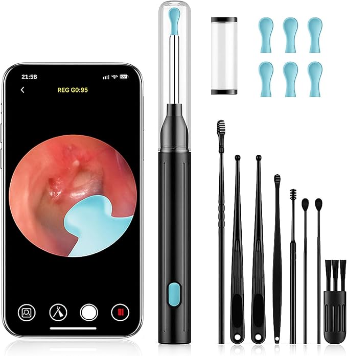 Ear Wax Removal Tool with Camera - 1296P HD Ear Cleaner Otoscope with 6 LED Lights, Wireless Earwax Remover Kit with 8 Pcs Ear Picks, WiFi Ear Scope Cleaning Kit for iPhone (Jet Black)