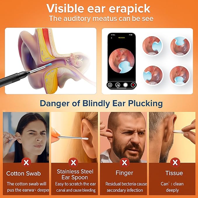 Ear Wax Removal Tool with Camera - 1296P HD Ear Cleaner Otoscope with 6 LED Lights, Wireless Earwax Remover Kit with 8 Pcs Ear Picks, WiFi Ear Scope Cleaning Kit for iPhone (Jet Black)