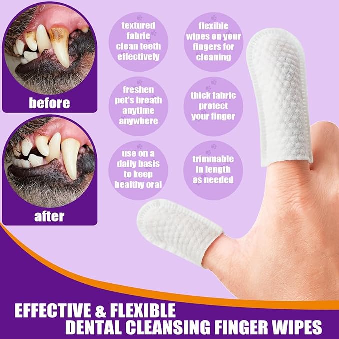 Teeth Cleaning Finger Wipes for Dogs & Cats, Soft Pet Dental Care Wipes, Disposable Pet Tooth Brushing Wipes, Gentle Cleaning & Gum Care Finger Pet Wipes (100 Wipes)