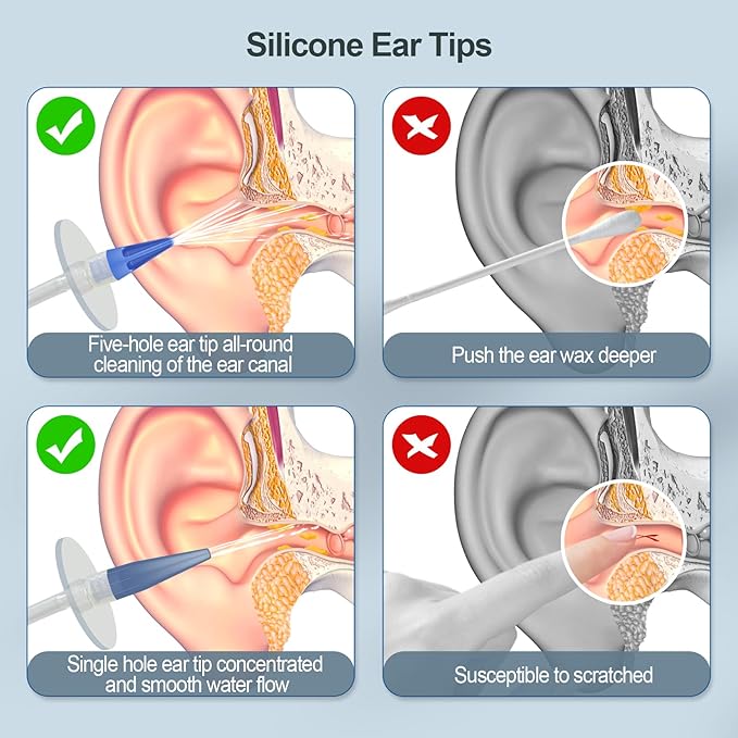 Ear Wax Removal Kit, Ear Cleaner Earwax Removal Kit, Ear Wax Cleaning Kit, Ear Irrigation Flushing System, Clean Ear Built Up Wax for Adults Kids, Ear Wax Removal Tool