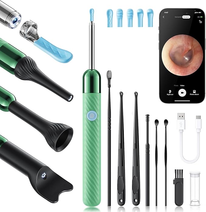 Loyker X6 Ear Wax Removal Tool Camera Otoscope with Light, Ear Wax Removal Kit with 6 Ear Pick, Ear Camera- Green