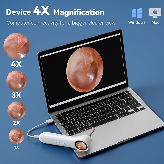 Ear Camera with 1.21” Screen, 1080P HD Digital Otoscope Ear Scope with 4 LED Lights, Ear Cleaner Camera with 10 Ear & Nose Tips, 6 Ear Pick Tools, Skin Probe, Type-C Charging for Adults Kids Pets