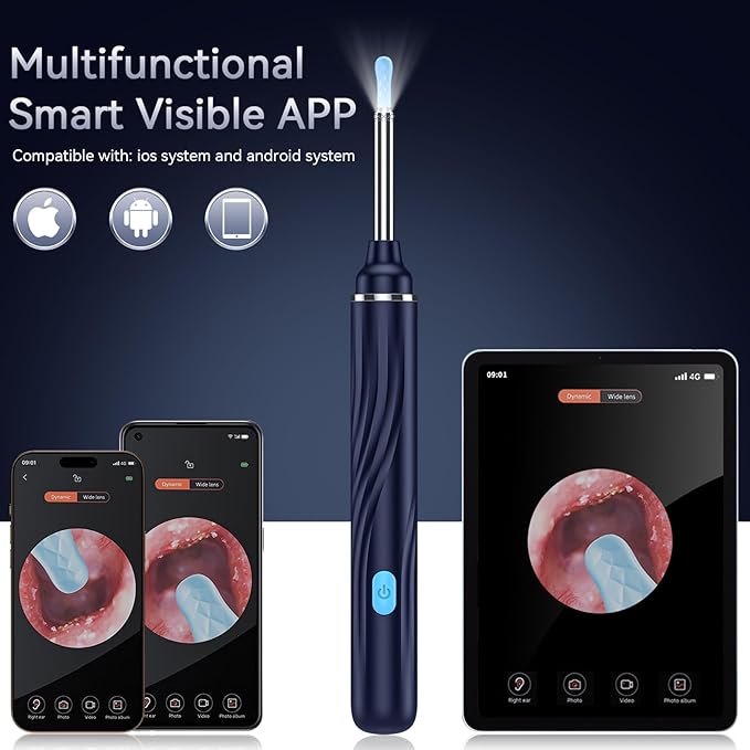 Tomaje Ear Wax Removal Tool Camera, Ear Cleaner with Camera, 1080P HD Ear Camera and 6 LED Light, Ear Wax Removal Kit with 6 Ear Pick, 6 Pcs Ear Set, Ear Camera Wax Removal for iOS & Android, Blue