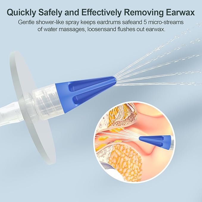 Ear Wax Removal Kit, Ear Cleaner Earwax Removal Kit, Ear Wax Cleaning Kit, Ear Irrigation Flushing System, Clean Ear Built Up Wax for Adults Kids, Ear Wax Removal Tool