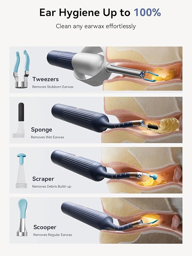 Ear Wax Removal Tool Camera: ZERONDER I35R Ear Cleaner with Flexible Ear Camera Otoscope - Visual Ear Pick Tweezers Wax Remover - Ear Cleaning Kit for Family
