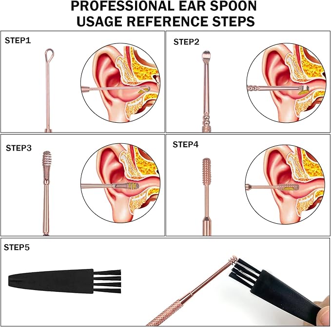 Hion 6 Pcs Ear Wax Removal Kit,Professional Double-Headed Ear Pick Earwax Removal Tools,316L Stainless Steel Ear Cleaner Curette with Cleaning Brush and Storage Box,Suit for Kid Adult(Rose Gold)