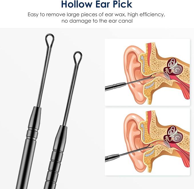 Ear Cleaning Kit,Safe Ear Wax Removal Tool,Earwax Removal Kit,Easy to Use,Painless Ear Pick,with Storage Box and Cleaning Brush (Black)