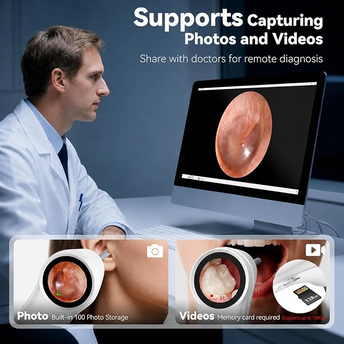 Ear Camera with 1.21” Screen, 1080P HD Digital Otoscope Ear Scope with 4 LED Lights, Ear Cleaner Camera with 10 Ear & Nose Tips, 6 Ear Pick Tools, Skin Probe, Type-C Charging for Adults Kids Pets