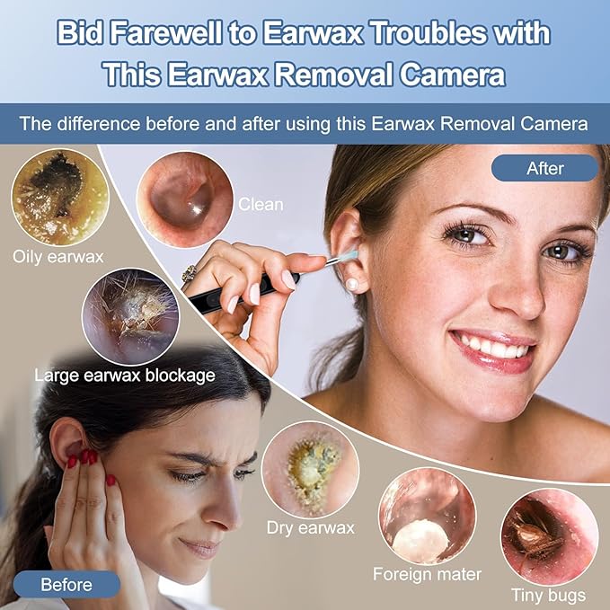 Ear Wax Removal, Ear Cleaner with Camera 1080P HD, Ear Wax Removal Kit Tools with 6 LED Lights/IP67 Waterproof Lens/8 Traditional, Rechargeable Ear Picker Cleaning kit for iOS/Android/Tablet, Black
