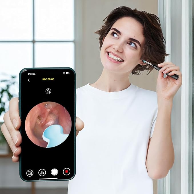 Ear Wax Removal Tool with Camera - 1296P HD Ear Cleaner Otoscope with 6 LED Lights, Wireless Earwax Remover Kit with 8 Pcs Ear Picks, WiFi Ear Scope Cleaning Kit for iPhone (Jet Black)