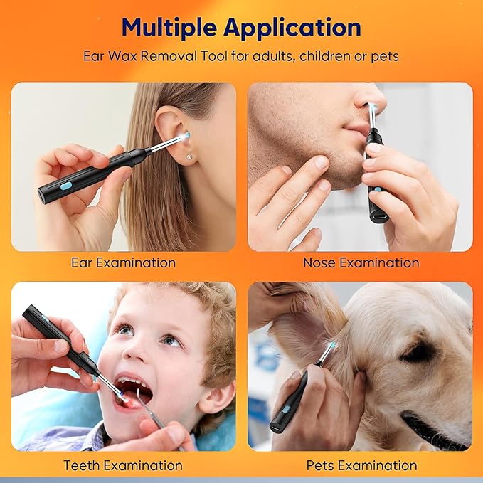 Ear Wax Removal Tool with Camera - 1296P HD Ear Cleaner Otoscope with 6 LED Lights, Wireless Earwax Remover Kit with 8 Pcs Ear Picks, WiFi Ear Scope Cleaning Kit for iPhone (Jet Black)