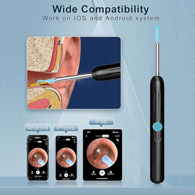 Ear Wax Removal Kit,Earwax Removal Tools with 1080P HD Camera and 6 LED Lights,IP67 Waterproof,Multi-Purpose 8 Pcs Ear Cleaning Kit,Easy to Use,Ear Cleaner with Camera for iOS and Android