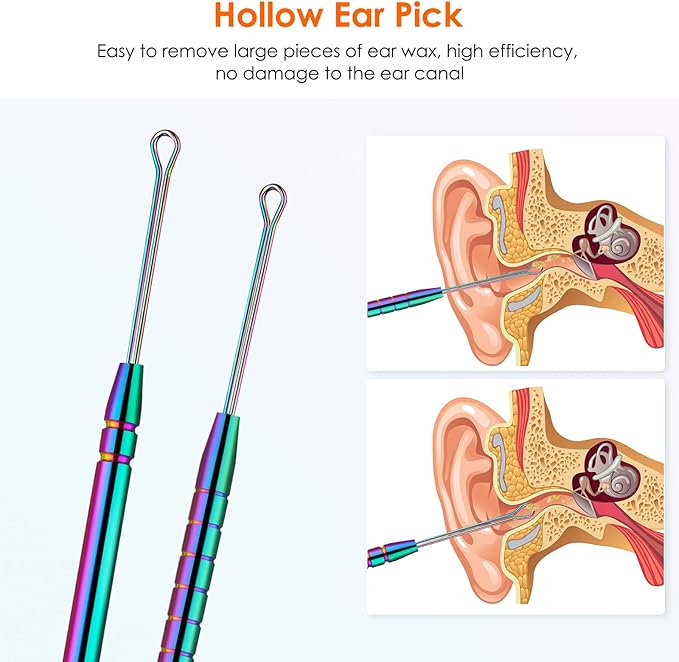 Ear Cleaning Kit,Safe Ear Wax Removal Tool,Earwax Removal Kit,Easy to Use,Painless Ear Pick,with Storage Box and Cleaning Brush (Titanium)