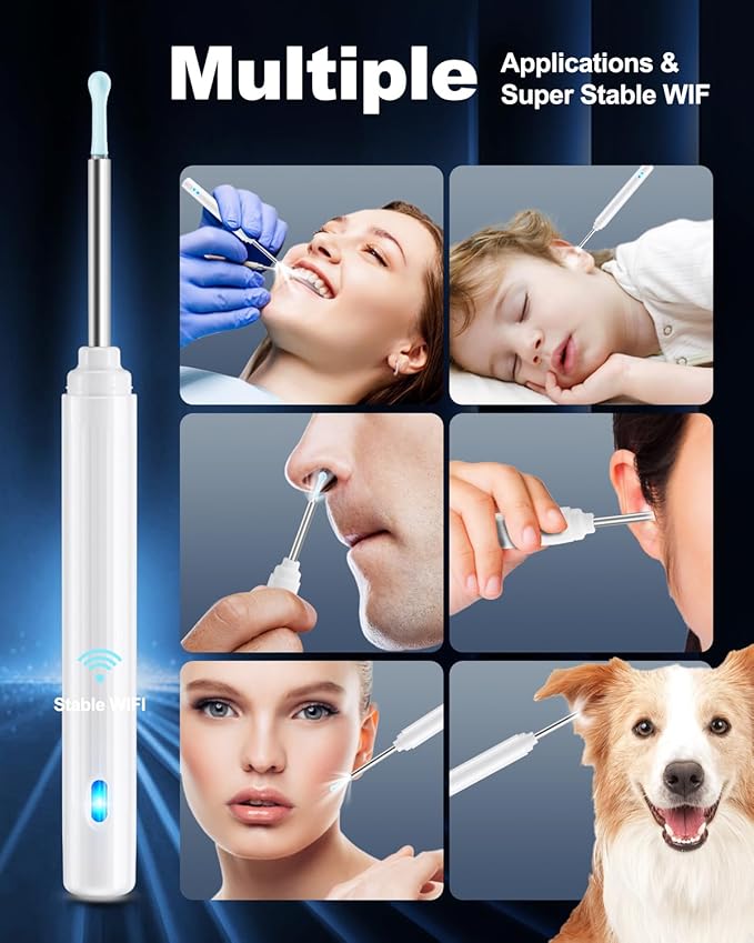 Ear Wax Removal Tool Camera, Ear Cleaner with Camera, Ear Cleaning Kit 1296P HD Ear Scope, 6 LED Lights and 6 Ear Picks, Earwax Removal with Otoscope to Earify Earwax for iOS and Android