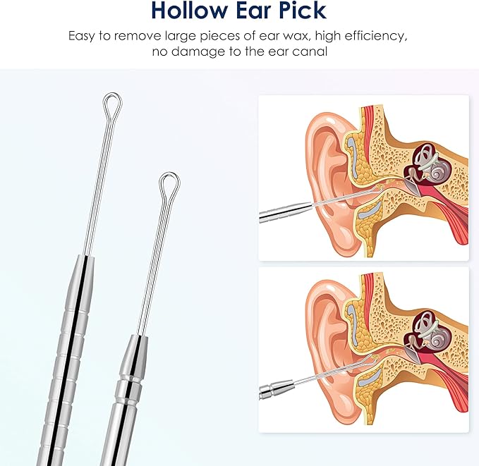 Ear Cleaning Kit,Safe Ear Wax Removal Tool,Earwax Removal Kit,Easy to Use,Painless Ear Pick,with Storage Box and Cleaning Brush (Silver)