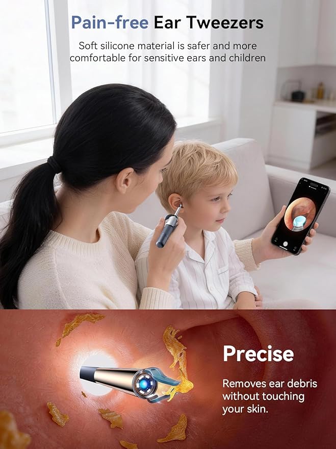 Ear Wax Removal Tool Camera: ZERONDER I35R Ear Cleaner with Flexible Ear Camera Otoscope - Visual Ear Pick Tweezers Wax Remover - Ear Cleaning Kit for Family