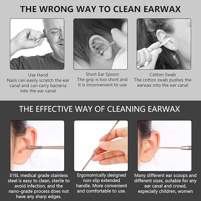 Hion 6 Pcs Ear Wax Removal Kit,Professional Double-Headed Ear Pick Earwax Removal Tools,316L Stainless Steel Ear Cleaner Curette with Cleaning Brush and Storage Box,Suit for Kid Adult(Rose Gold)