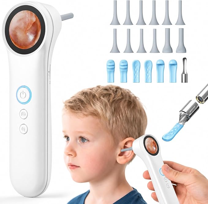 Ear Camera with 1.21” Screen, 1080P HD Digital Otoscope Ear Scope with 4 LED Lights, Ear Cleaner Camera with 10 Ear & Nose Tips, 6 Ear Pick Tools, Skin Probe, Type-C Charging for Adults Kids Pets