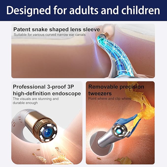 Ear Wax Removal Tool Camera, Smart WiFi Ear Cleaner with Camera, HD Visual Otoscope, Safe Silicone Flexible Scoops & Tweezers Sets Tools for Adults & Kids