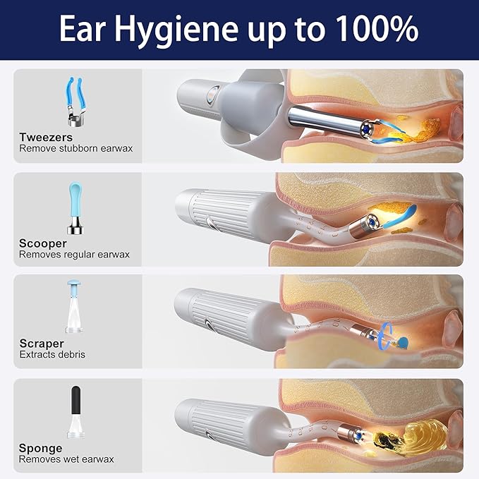 Ear Wax Removal Tool Camera, Smart WiFi Ear Cleaner with Camera, HD Visual Otoscope, Safe Silicone Flexible Scoops & Tweezers Sets Tools for Adults & Kids