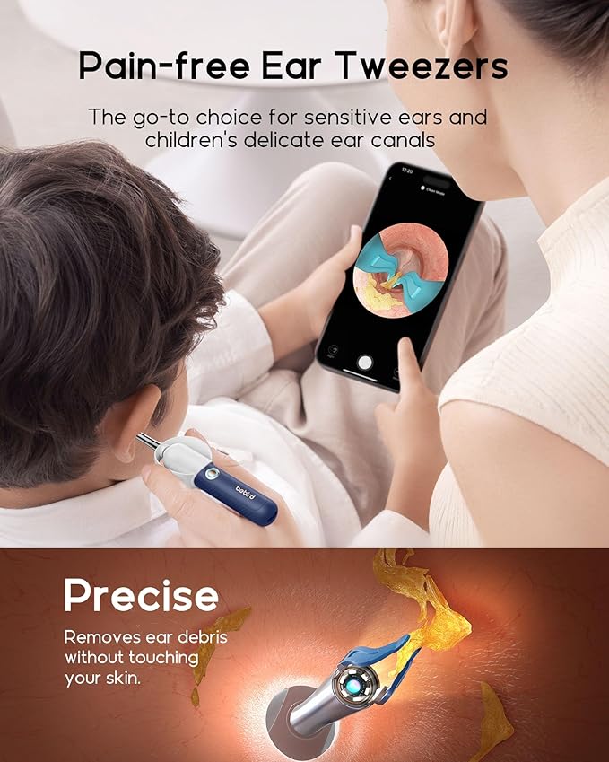 Bebird Earsight Plus R37R Ear Wax Removal Tool Camera, FSA HSA Eligible Items, Smart Ear Cleaner with Painless Visual Tweezers, Flexible Ear Camera Otoscope, Home ENT Cleaning Kit for Family,Blue